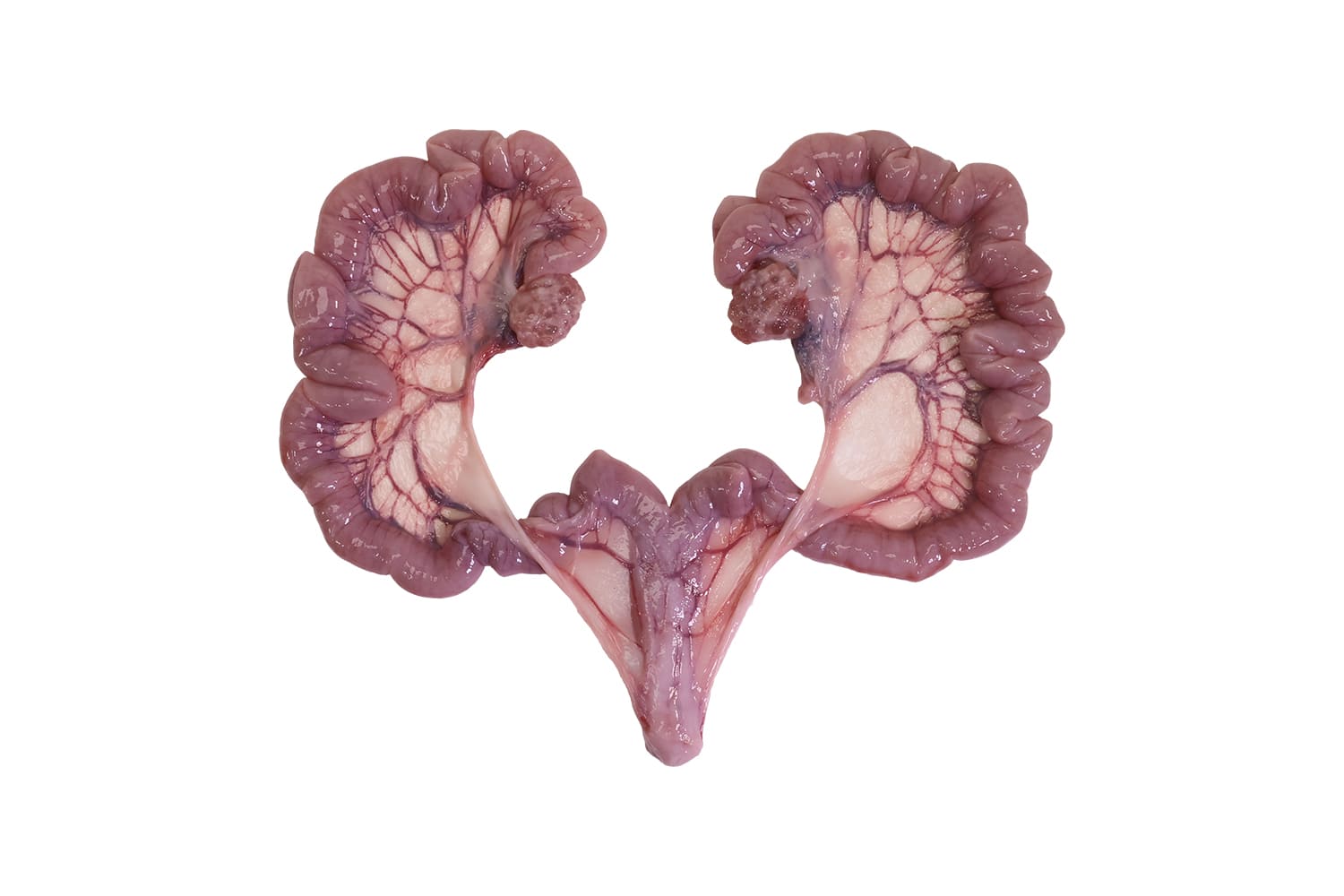 UTERUS