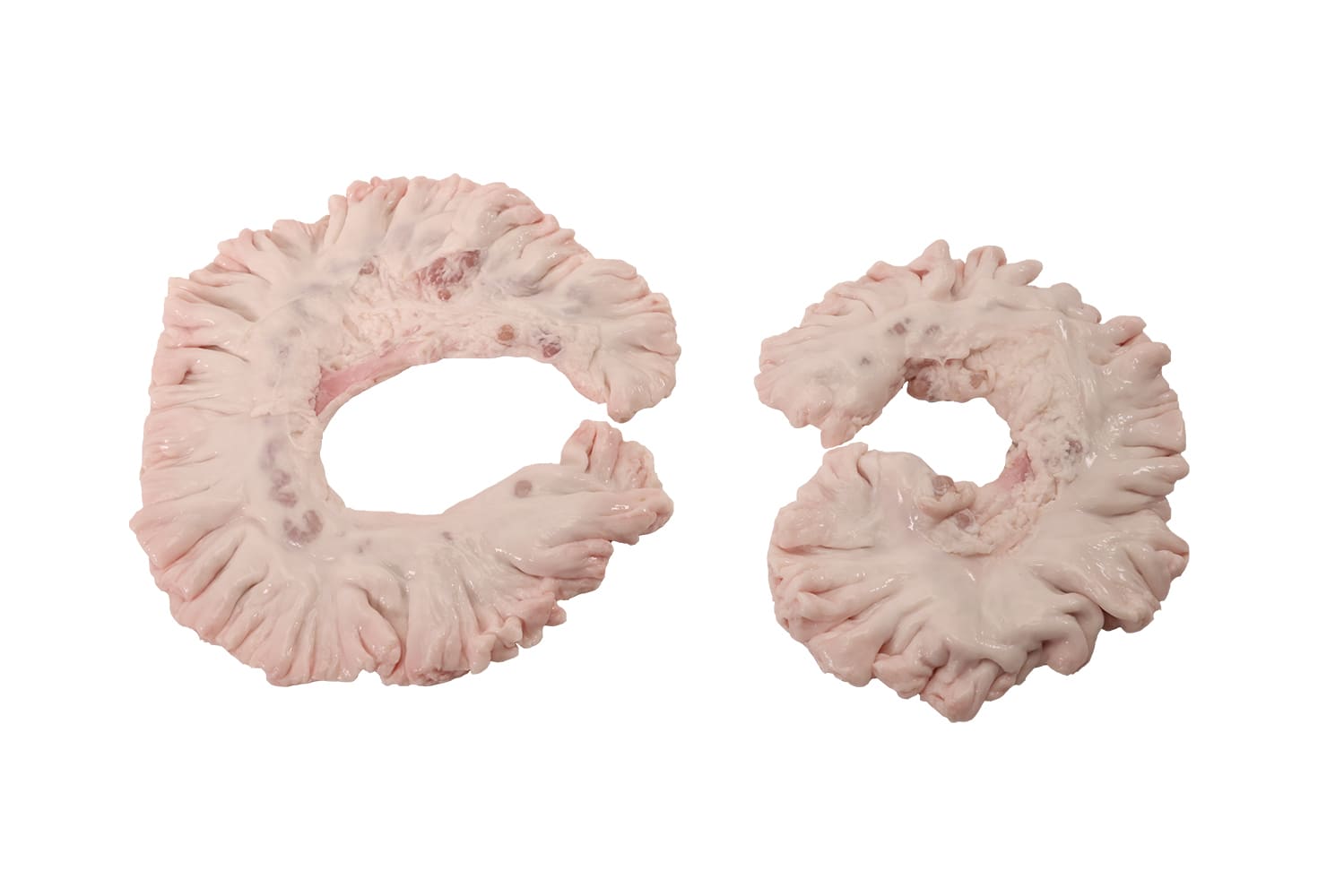 MESENTERY